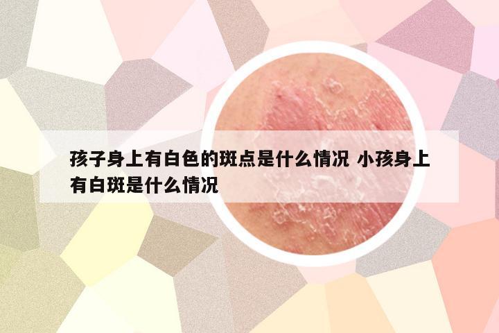 孩子身上有白色的斑点是什么情况 小孩身上有白斑是什么情况