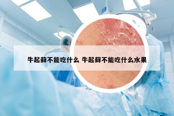 牛起藓不能吃什么 牛起藓不能吃什么水果