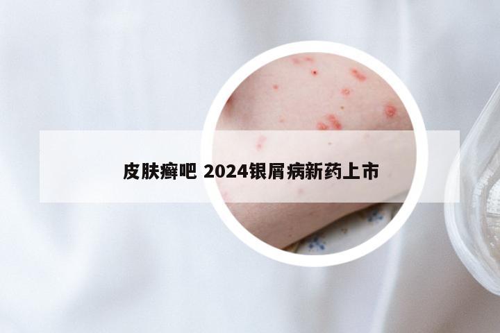 皮肤癣吧 2024银屑病新药上市