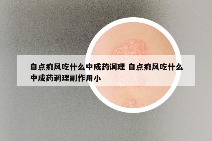 白点癫风吃什么中成药调理 白点癫风吃什么中成药调理副作用小