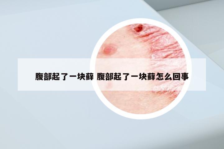 腹部起了一块藓 腹部起了一块藓怎么回事