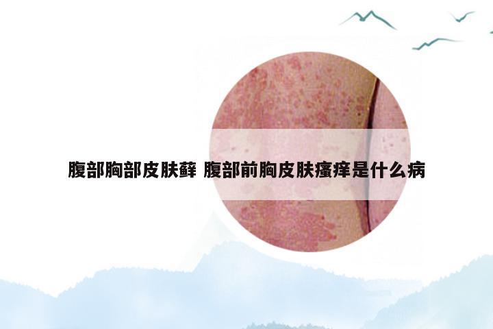 腹部胸部皮肤藓 腹部前胸皮肤瘙痒是什么病