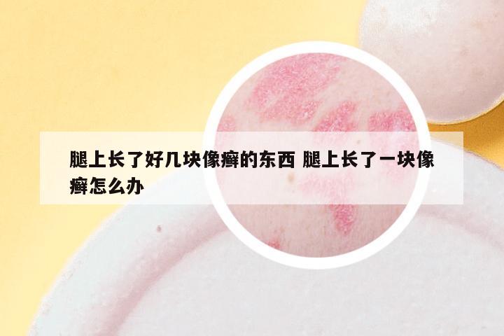 腿上长了好几块像癣的东西 腿上长了一块像癣怎么办