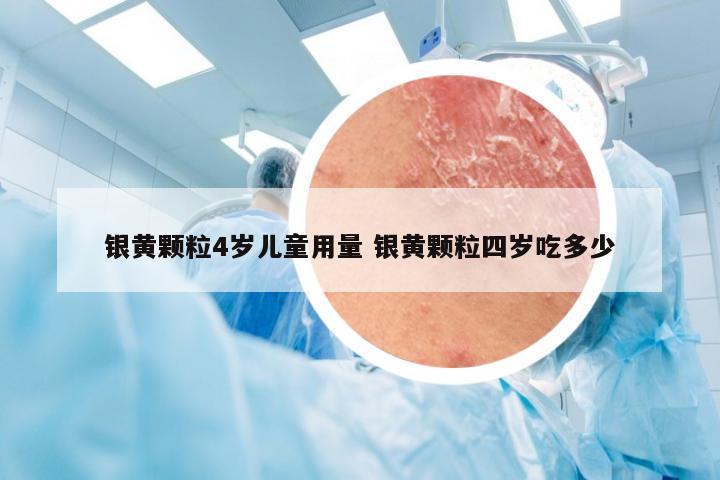 银黄颗粒4岁儿童用量 银黄颗粒四岁吃多少