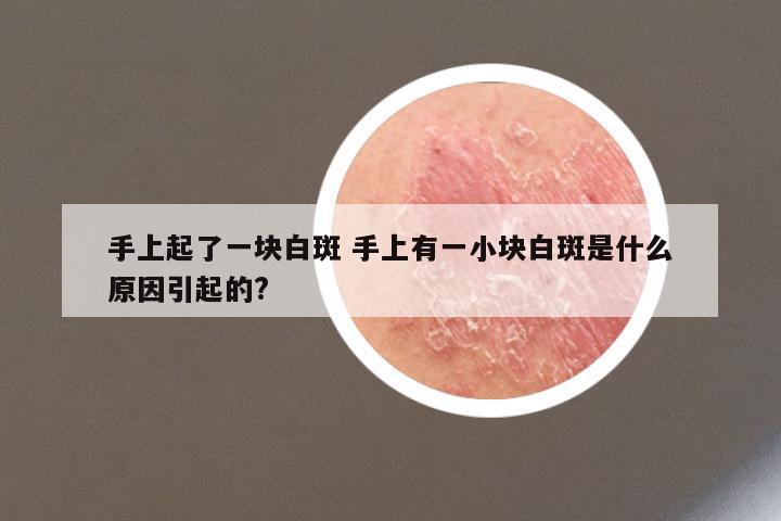 手上起了一块白斑 手上有一小块白斑是什么原因引起的?