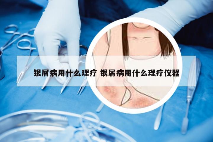 银屑病用什么理疗 银屑病用什么理疗仪器