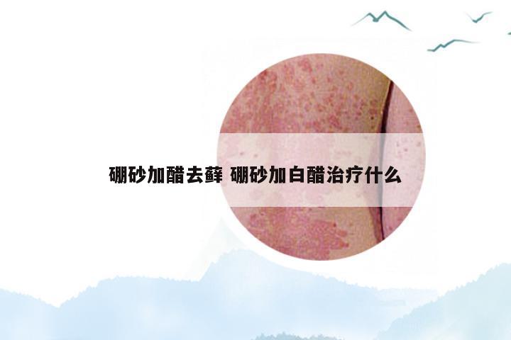 硼砂加醋去藓 硼砂加白醋治疗什么