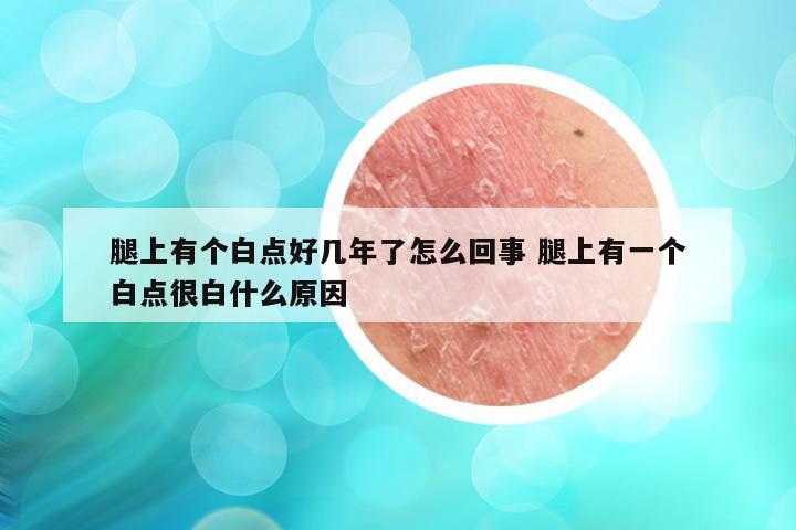 腿上有个白点好几年了怎么回事 腿上有一个白点很白什么原因