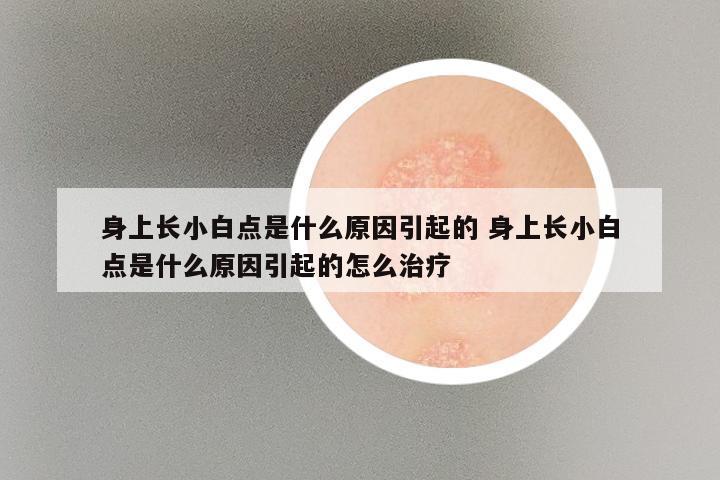 身上长小白点是什么原因引起的 身上长小白点是什么原因引起的怎么治疗