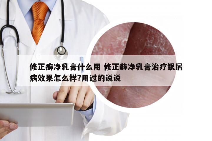 修正癣净乳膏什么用 修正藓净乳膏治疗银屑病效果怎么样?用过的说说