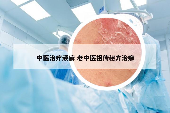 中医治疗顽癣 老中医祖传秘方治癣