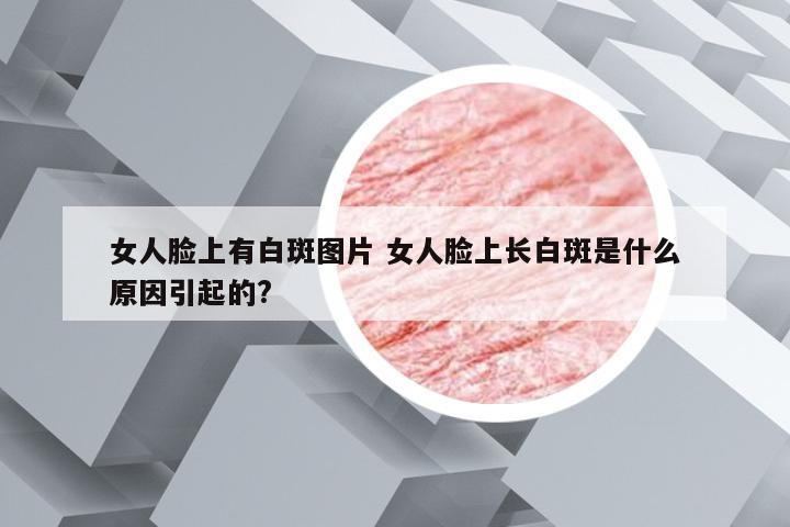 女人脸上有白斑图片 女人脸上长白斑是什么原因引起的?