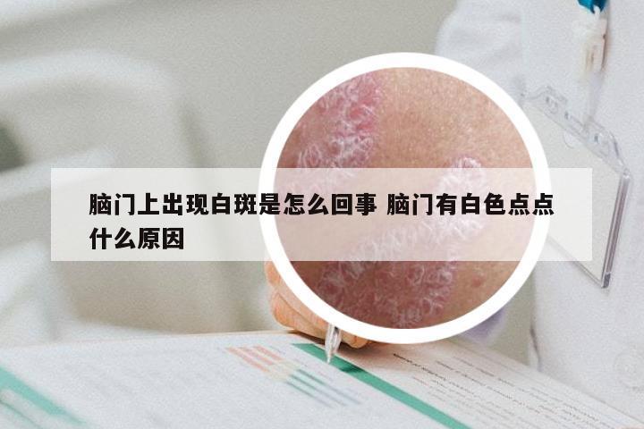 脑门上出现白斑是怎么回事 脑门有白色点点什么原因