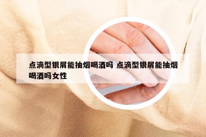 点滴型银屑能抽烟喝酒吗 点滴型银屑能抽烟喝酒吗女性