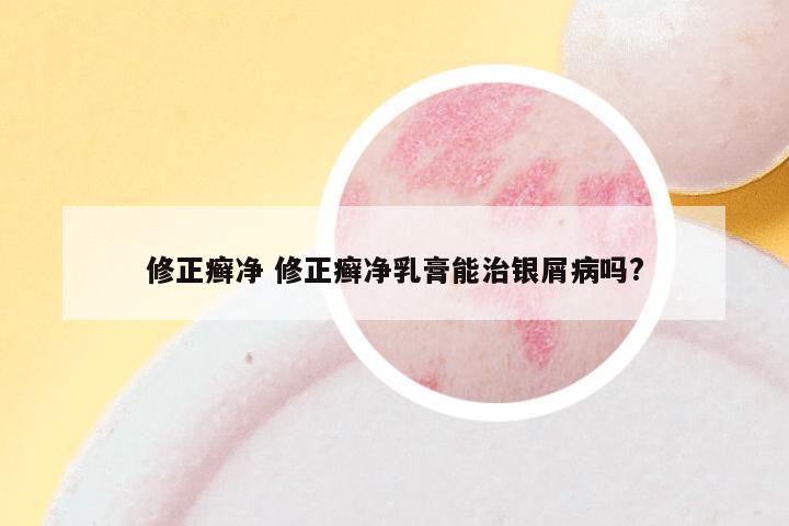 修正癣净 修正癣净乳膏能治银屑病吗?