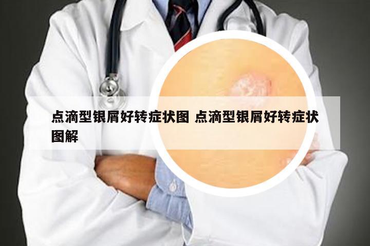 点滴型银屑好转症状图 点滴型银屑好转症状图解