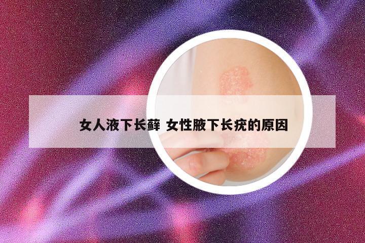 女人液下长藓 女性腋下长疣的原因