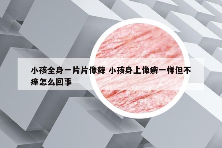 小孩全身一片片像藓 小孩身上像癣一样但不痒怎么回事