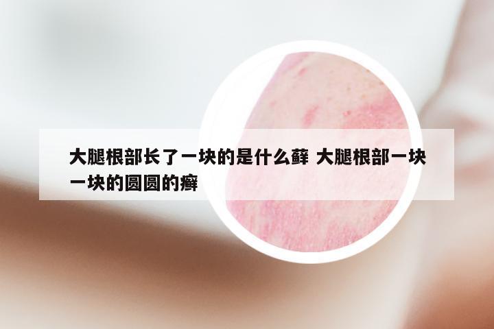 大腿根部长了一块的是什么藓 大腿根部一块一块的圆圆的癣