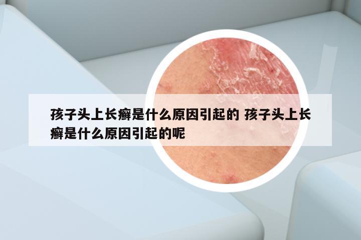 孩子头上长癣是什么原因引起的 孩子头上长癣是什么原因引起的呢