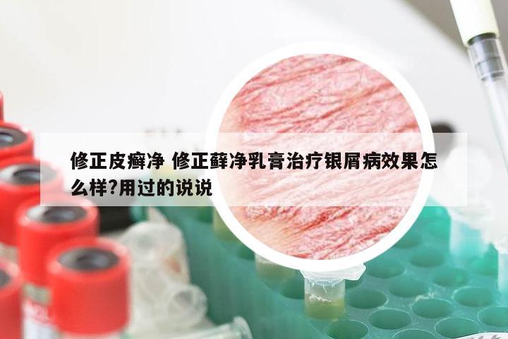 修正皮癣净 修正藓净乳膏治疗银屑病效果怎么样?用过的说说