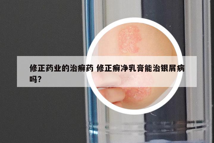 修正药业的治癣药 修正癣净乳膏能治银屑病吗?