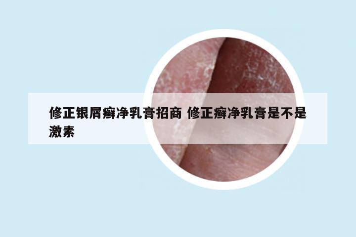 修正银屑癣净乳膏招商 修正癣净乳膏是不是激素