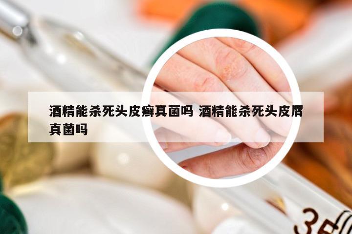 酒精能杀死头皮癣真菌吗 酒精能杀死头皮屑真菌吗