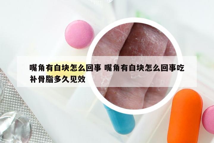 嘴角有白块怎么回事 嘴角有白块怎么回事吃补骨脂多久见效