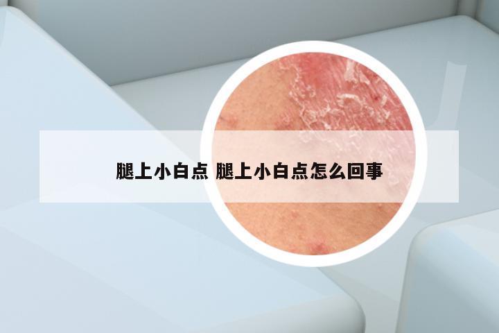 腿上小白点 腿上小白点怎么回事