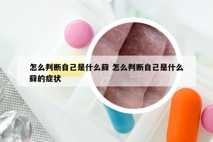 怎么判断自己是什么藓 怎么判断自己是什么藓的症状