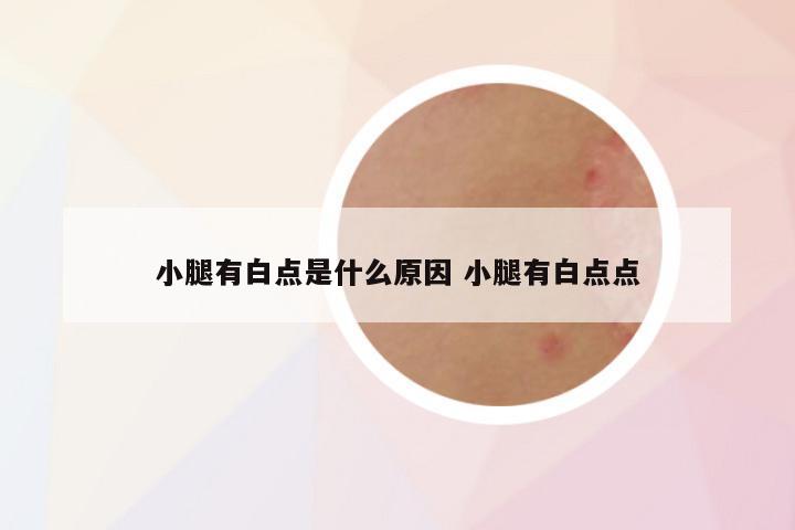 小腿有白点是什么原因 小腿有白点点