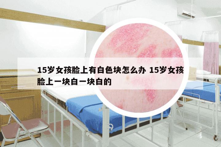 15岁女孩脸上有白色块怎么办 15岁女孩脸上一块白一块白的