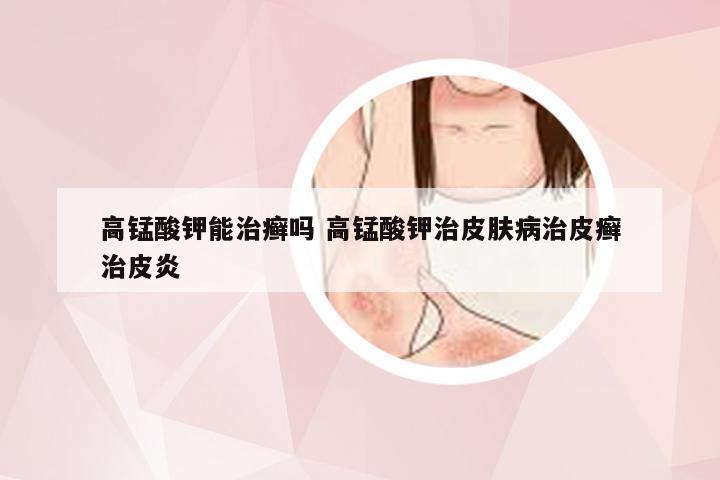 高锰酸钾能治癣吗 高锰酸钾治皮肤病治皮癣治皮炎