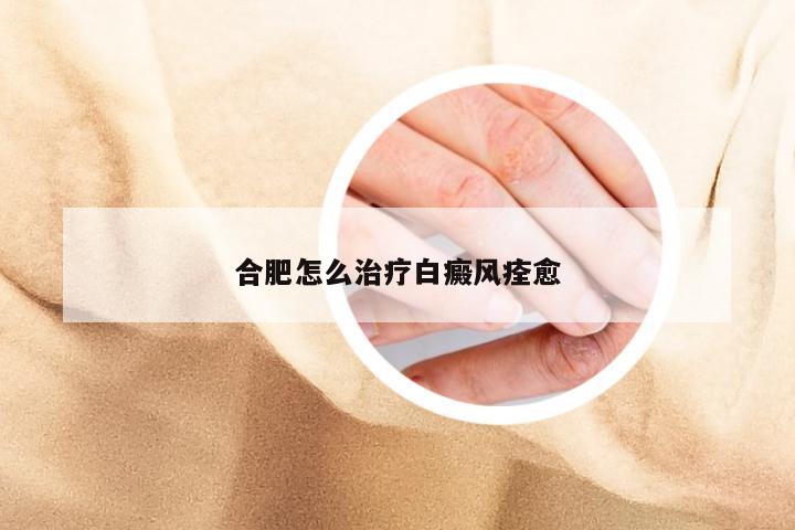 合肥怎么治疗白癜风痊愈