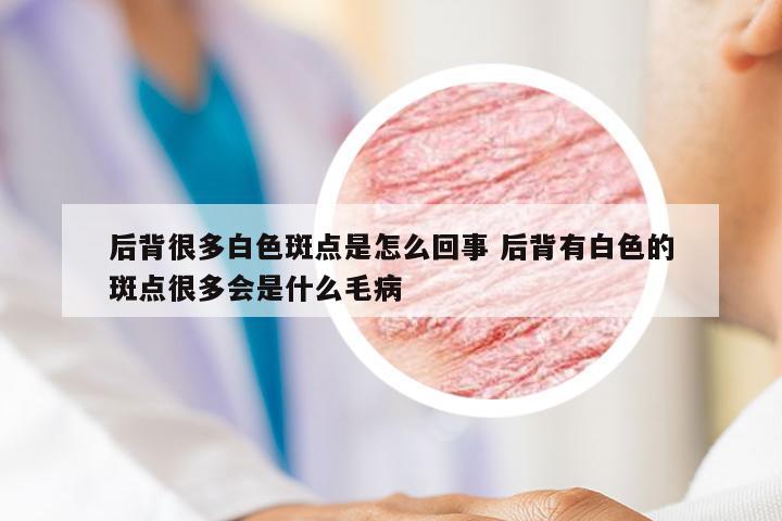 后背很多白色斑点是怎么回事 后背有白色的斑点很多会是什么毛病