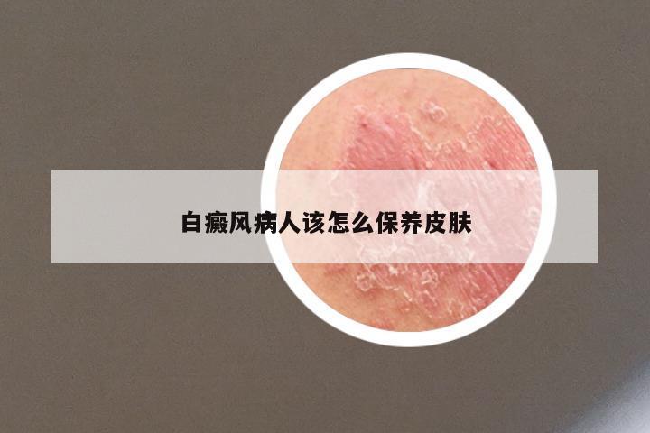 白癜风病人该怎么保养皮肤