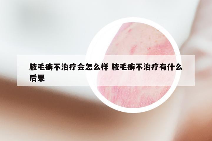 腋毛癣不治疗会怎么样 腋毛癣不治疗有什么后果