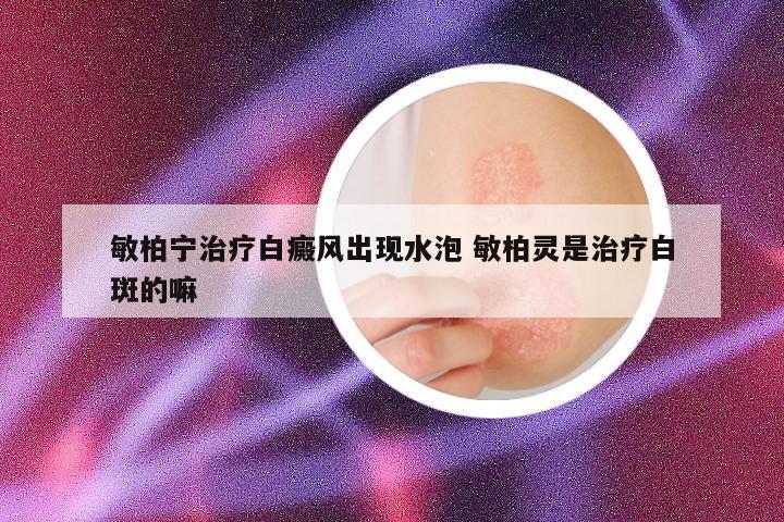 敏柏宁治疗白癜风出现水泡 敏柏灵是治疗白斑的嘛