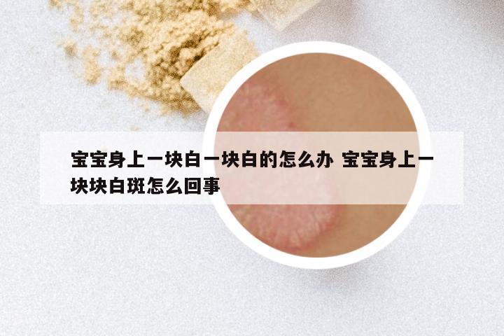 宝宝身上一块白一块白的怎么办 宝宝身上一块块白斑怎么回事