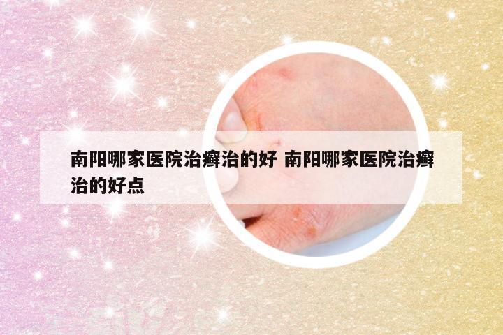 南阳哪家医院治癣治的好 南阳哪家医院治癣治的好点