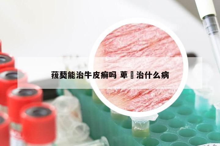 菝葜能治牛皮癣吗 萆薢治什么病