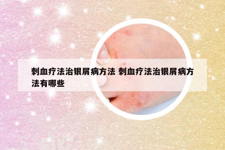 刺血疗法治银屑病方法 刺血疗法治银屑病方法有哪些