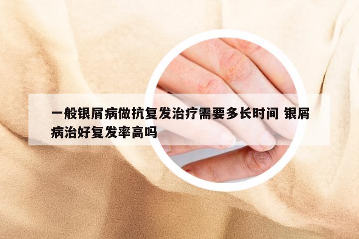 一般银屑病做抗复发治疗需要多长时间 银屑病治好复发率高吗