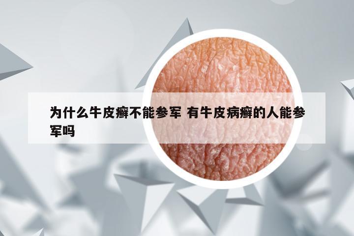 为什么牛皮癣不能参军 有牛皮病癣的人能参军吗