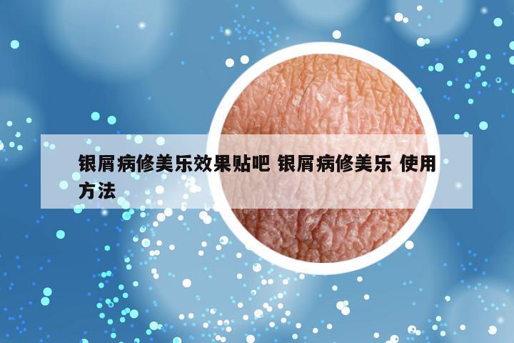 银屑病修美乐效果贴吧 银屑病修美乐 使用方法