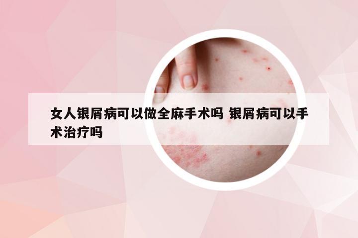 女人银屑病可以做全麻手术吗 银屑病可以手术治疗吗