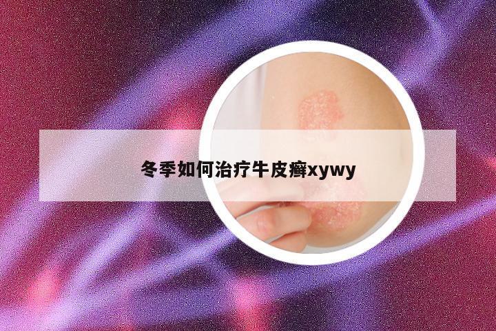 冬季如何治疗牛皮癣xywy