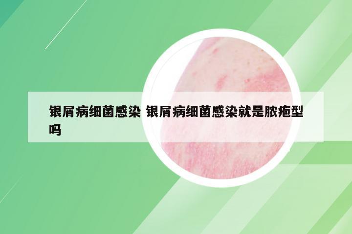 银屑病细菌感染 银屑病细菌感染就是脓疱型吗