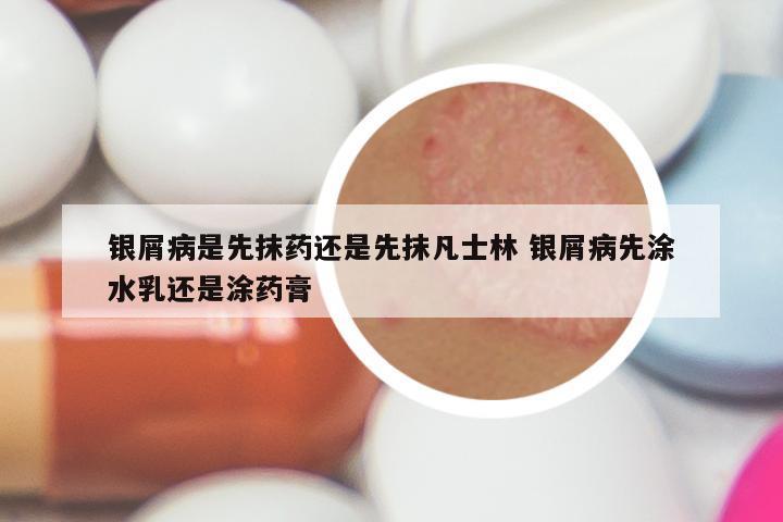 银屑病是先抹药还是先抹凡士林 银屑病先涂水乳还是涂药膏